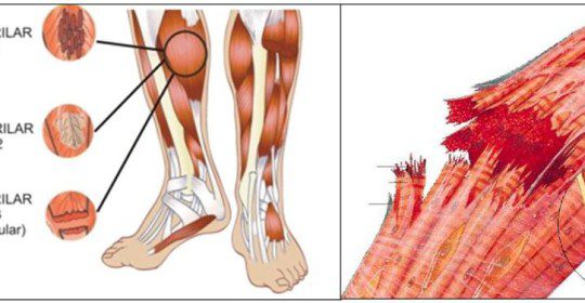 Rotura fiblilar - Como trabaja la osteopatia