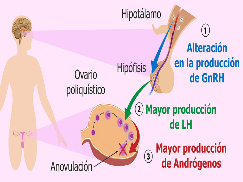 Reducir androgenos en mujeres