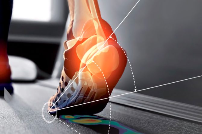 ¿Sufres de dolor de espalda? La podología podría ser tu solución